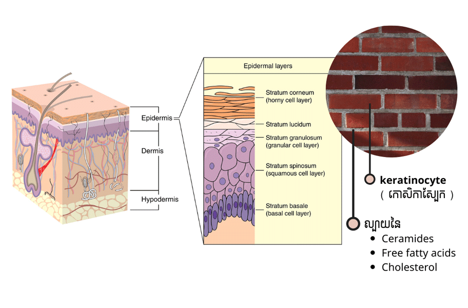 Skin barriers